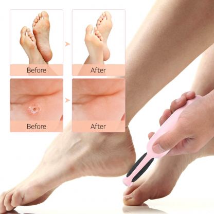 Abko Electric Callus Remover CR01 - безжична електрическа пила за крака (сив) 5