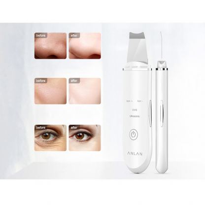 Anlan Ultrasonic Skin Scrubber - ултразвуков уред за почистване на лице (бял) 6